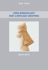 Open Rhinoplasty and Cartilage Grafting