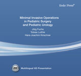 Minimal Invasive Paediatric Surgery and -Urology