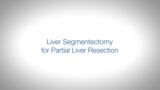 ICG-Webclip "Liver-Segmentectomy-for-Partial-Liver-Resection"