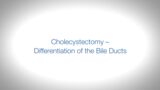 ICG-Webclip "Cholecystectomy – Differentiation od the Bile Ducts"